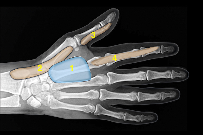 ANATOMY Hand Surgery Resource anatomy-hand-surgery-resource